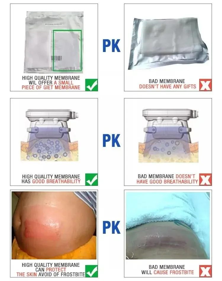 Anti-Freeze Membrane 27*30 34*42Cm Anti Freezeing Anti-Cryo Antifreeze Membrane Cool Cryo Pad Freeze Anti Freeze