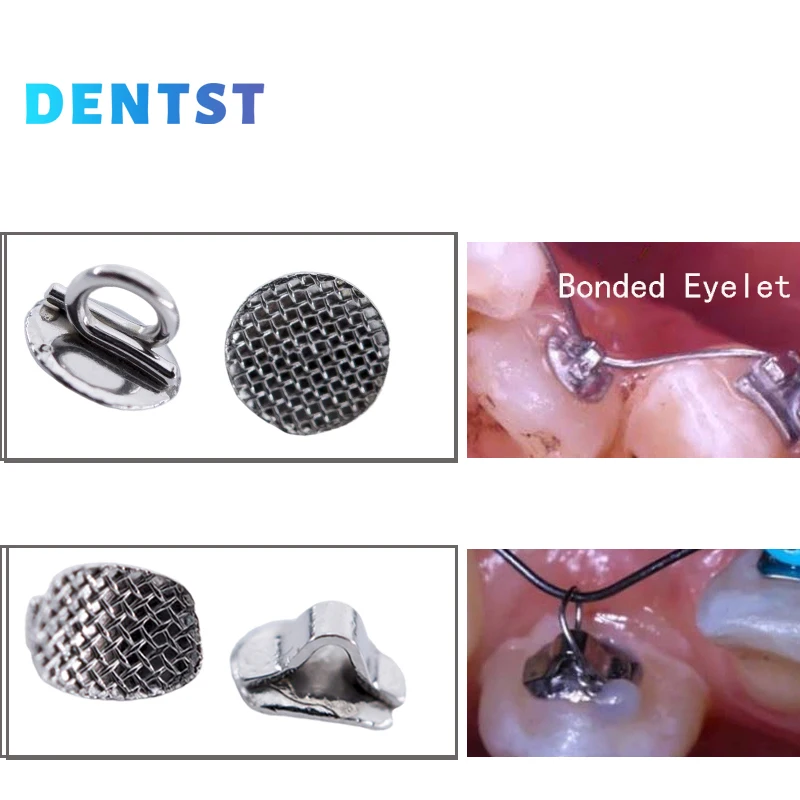 50pcs Orthodontic Dental Direct Bond Eyelet Lingual Buttons Tongue Tamers Bite Opener Cleat Small Sliding Crimpable Hook Tools