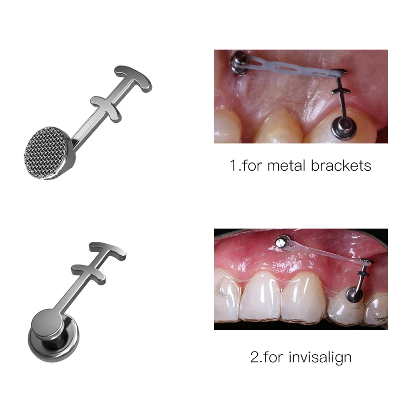 50pcs Dental Orthodontic Lingual Button Bondable Power Arms Adhesive Bracket Brace Archwires Crimpable Hook Lingual Small cleat