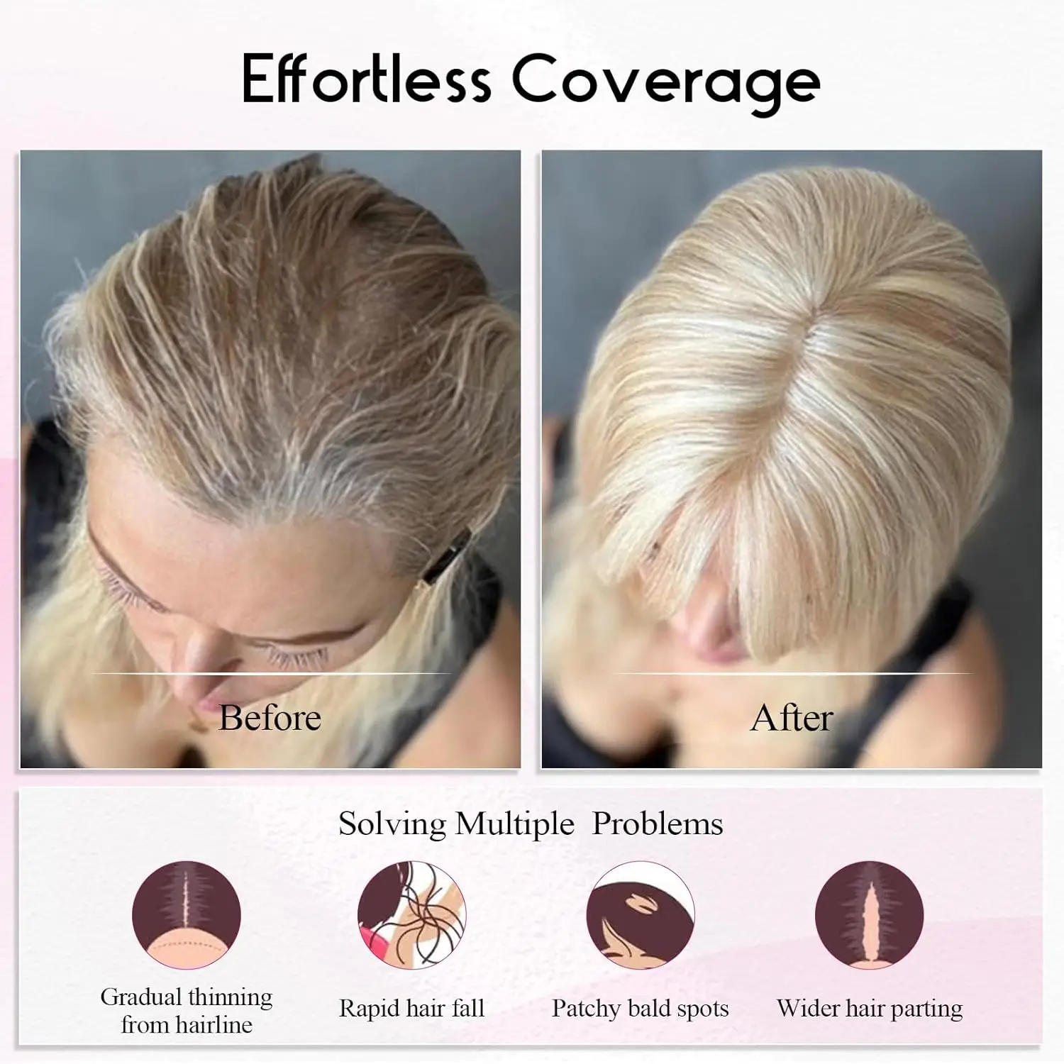 Mixed Blonde Human Hair Toppers 12 inch Human Hair Clip in Bangs Hair Pieces Skin 360° Cover Hair Extension for Women Loss Hair