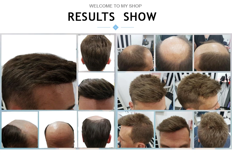 Men's 100% Human India Hair Toupee 8x10 Inch Top Swiss Lace Front with Natural Thin Skin 6 Inch Length Hair Base Stock