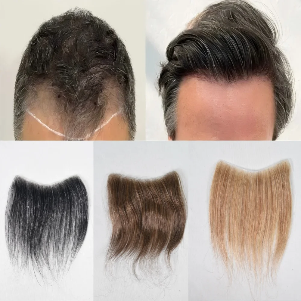 Men's Forehead Hairline Wig High Density Human Hair Skin PU Men's Frontal Hairpiece V Ring Frontal Hair Top