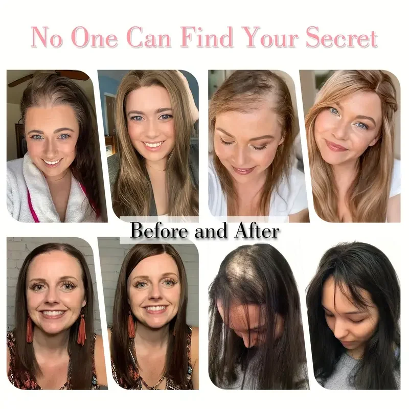 12in Hair Toppers for Women Real Human Hair Pieces Brown Blonde Highlight 10*12cm Silk Base Toppers for Women With Thinning Hair