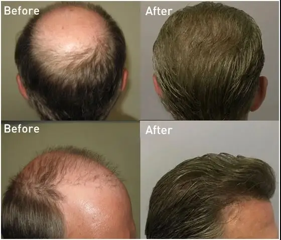 Stock 5 Inch Dura Australia Man Toupee Indian Human Hair Lace And Pu Base Hair System For Men Hair Prosthesis Free Shipping