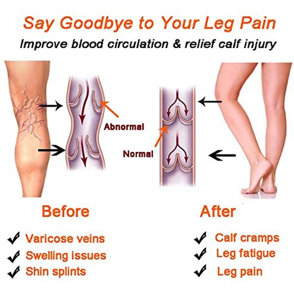 Medical Calf Compression Sleeve 30-40mmhg Men Women Footless Calves Compression Sleeves Varicose Veins