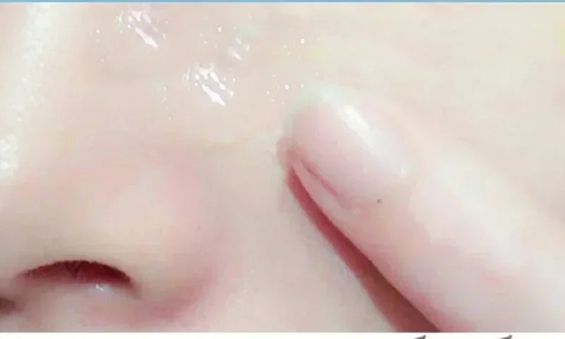20ml Salicylic Acid Face Cream Shrink Pore Rejuvenate Moisturising Nourish Blackheads Remove Cream Anti-aging Oil Control Serum