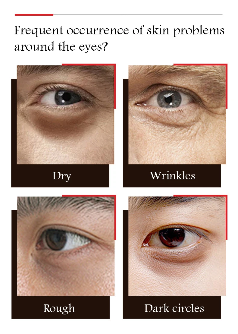 1/2/3pcs VENZEN Men's Eye Cream Anti Dark Circles Remove Eye Bags Firming Moisturizing Eyes Cream for Men Eyes Skin Care