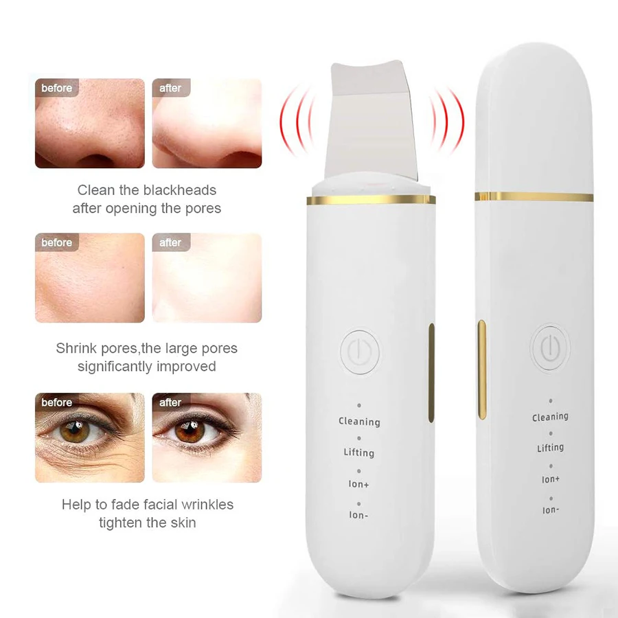 Ultrasonic Skin Scrubber Face Spatula Pore Cleaner Blackhead Remover Shovel Skin Care Tool for Facial Lifting and Deep Cleansing