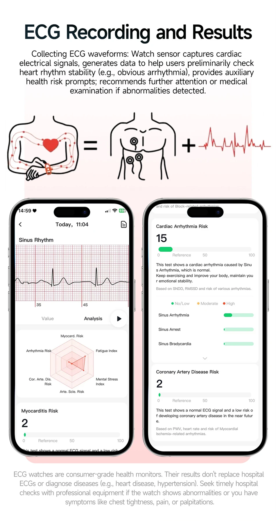 2026 Original Women Health Accurate Diagnosis Smart Watch ECG+HRV BP Blood Oxygen Uric Acid Heart Rate Bluetooth Call Smartwatch