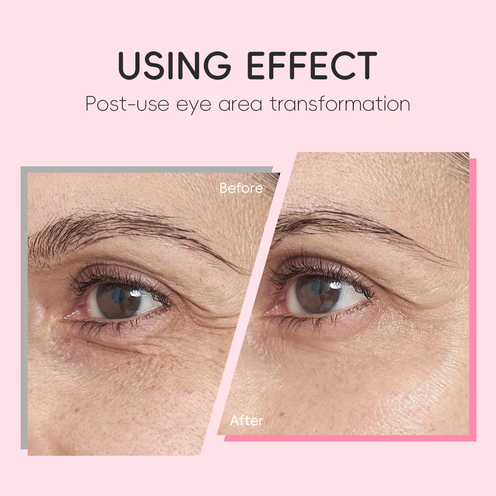 LAIKOU 15ml Sakura Roller Eye Serum Hyaluronic Acid Moisturizing Fade Dark Circles Eye Bags Fine Lines Massage Eye Care