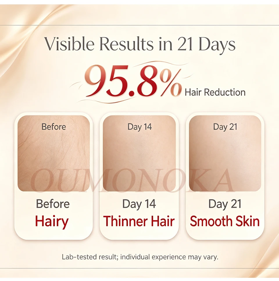 Permanent Women's Electric Epilators Choice Female Facial IPL Laser  Remover Electric Shaver Epilator for Women Laser Epilator