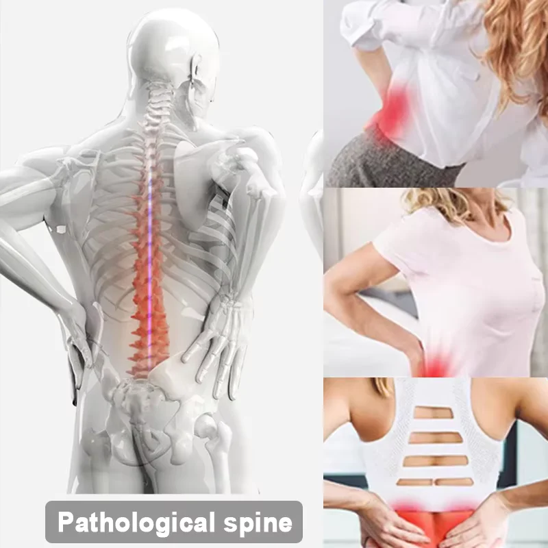 Lumbar Relief Device Cervical Spine Lumbar Spine Stretching Corrector Lumbar Massager Lumbar Support Tool Waist Stretcher