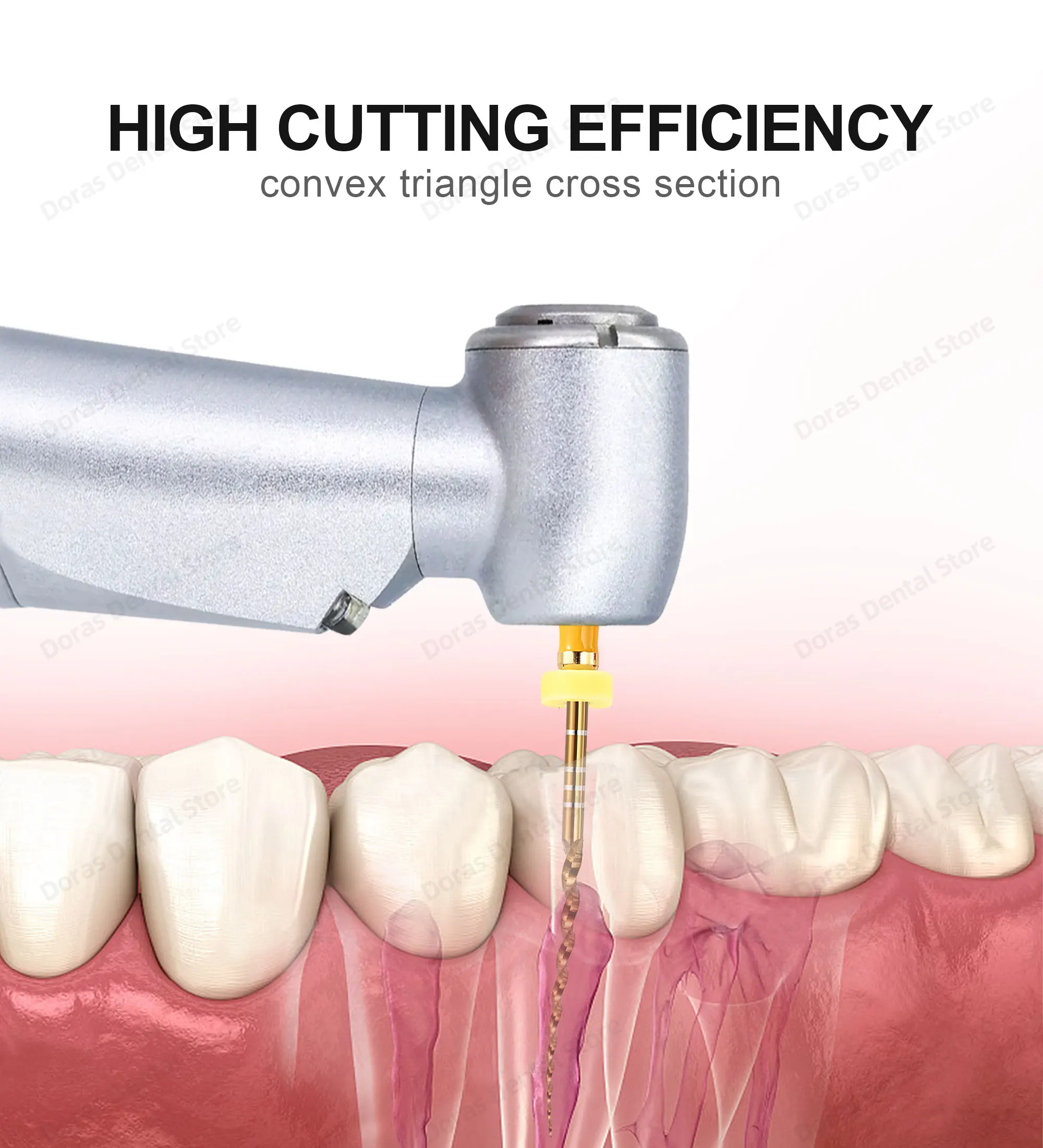 Glin Dental Gold Flexible Files Endo Rotary Files Golden Endodontic Files 21/25/31mm Nickel Titanium Instrument Dentistry