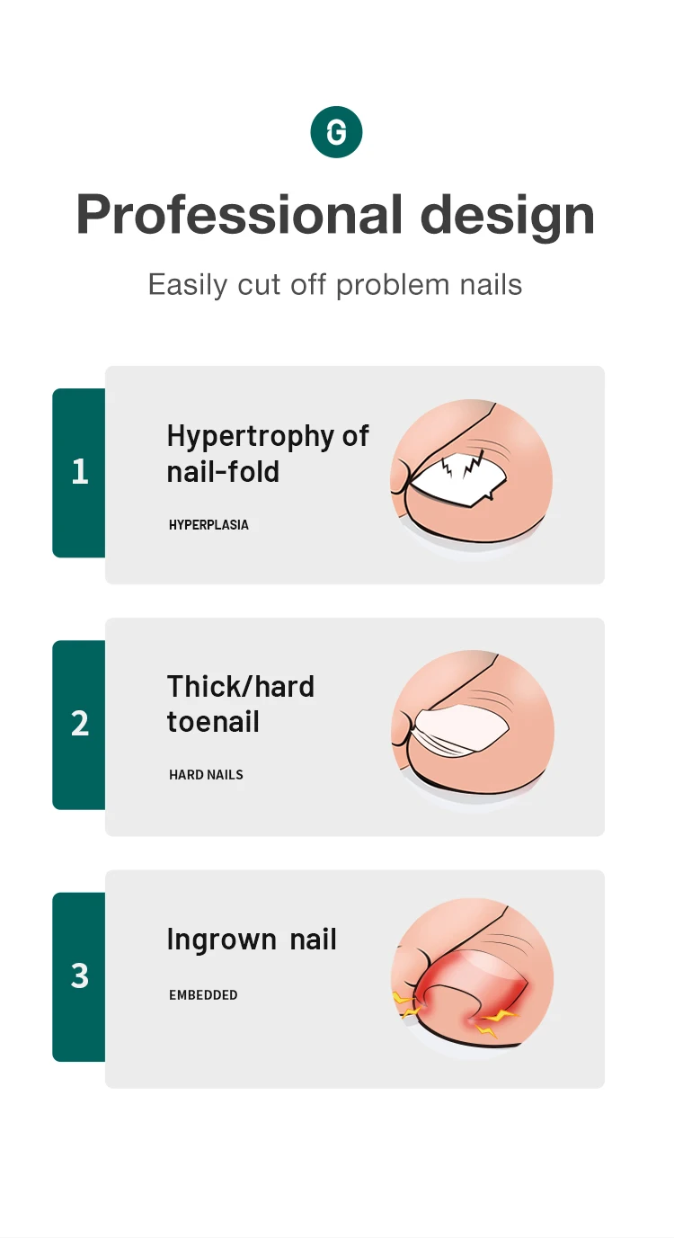 MR.GREEN Toenail Pincers Ingrown Nail Clippers Cutter Stainless Steel Pedicure Tools Thick Toe Nail Deep Into Nail Grooves