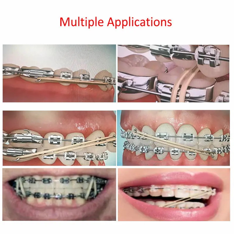 5Bags Dental Orthodontic Rubber Band Zoo Pack Rubber Bands Latex Braces 3.5Oz/5Oz/6.5Oz Optional