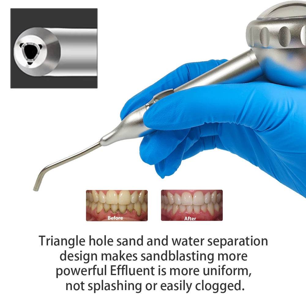 Dental Air Water Polisher Jet Air Flow Oral Hygiene Tooth Cleaning Prophy Polishing Tool Teeth Whitening Cleaning Gun Pen